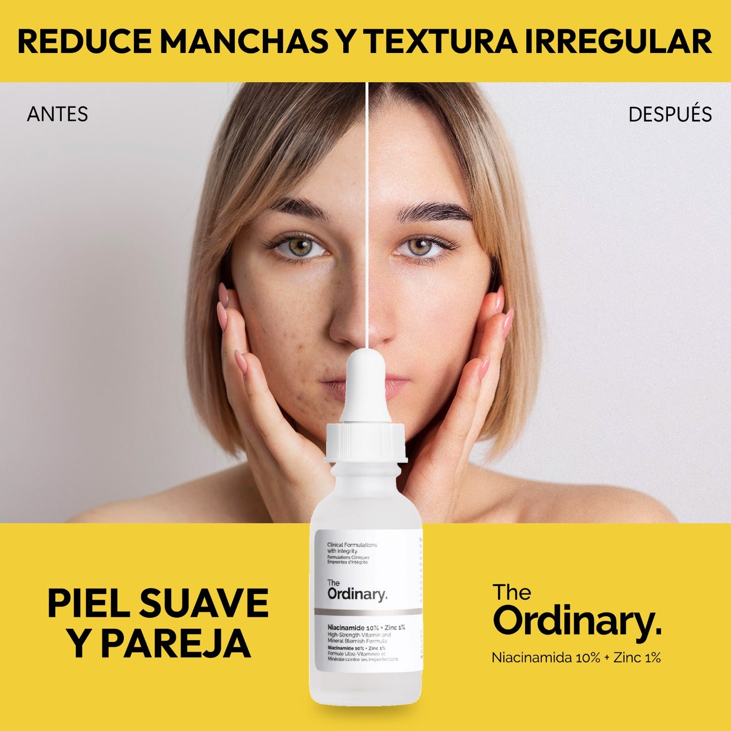 SERUM NIACINAMIDA 10% + ZINC 1% THE ORDINARY